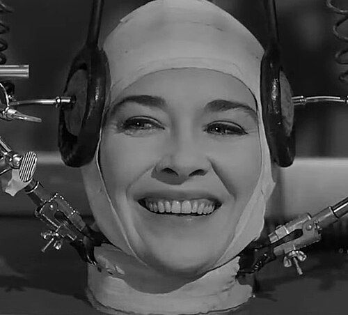 The Brain That Wouldn't Die